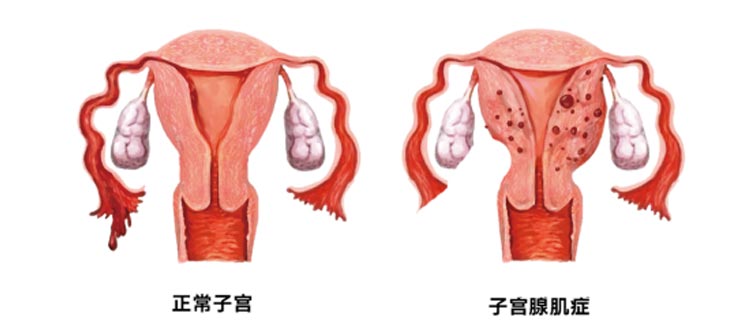 症状示意图